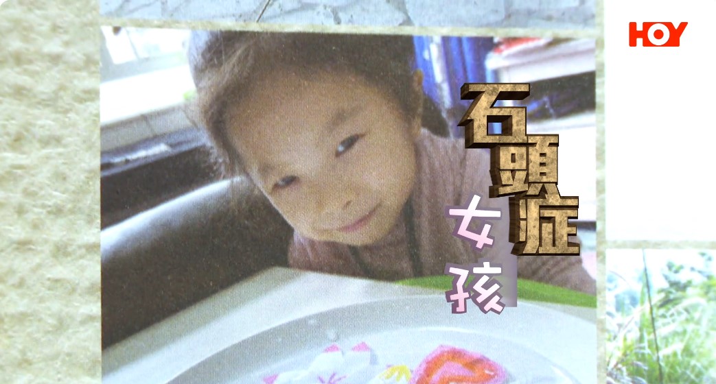 Hoy TV《小事大意義》<br />石頭症女孩<br />