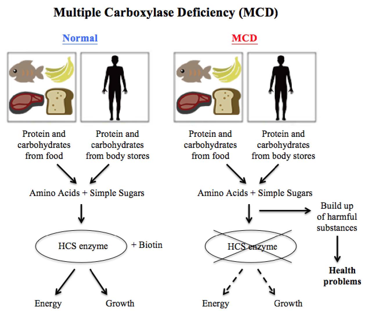 Multiple carboxylase deficiency diagram