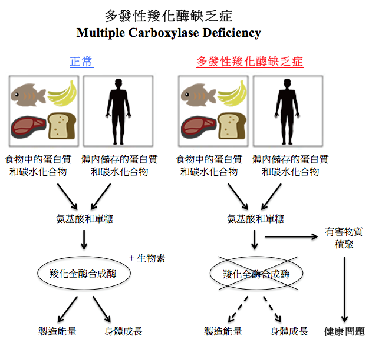 多發性羧化酶缺乏症圖解