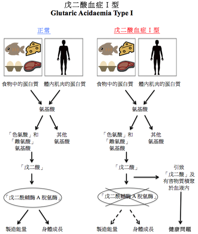 戊二酸血症 I 型圖解