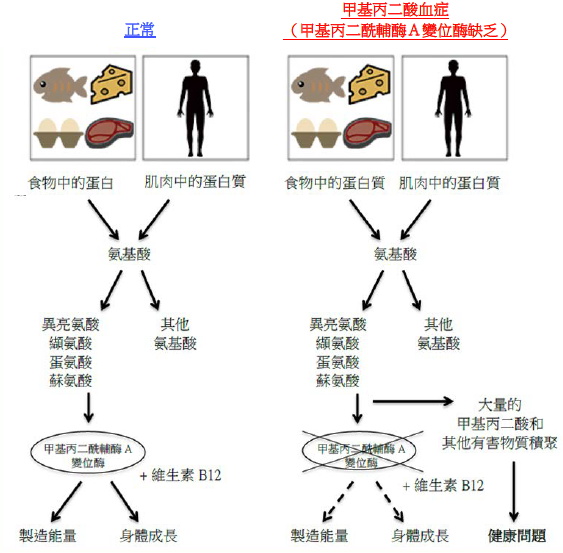 甲基丙二酸血症（甲基丙二酰輔酶A變位酶缺乏）圖解