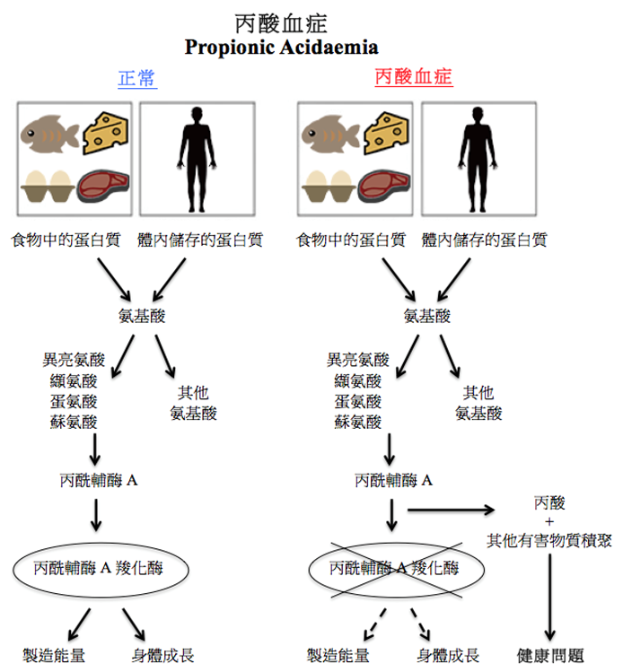 丙酸血症圖解