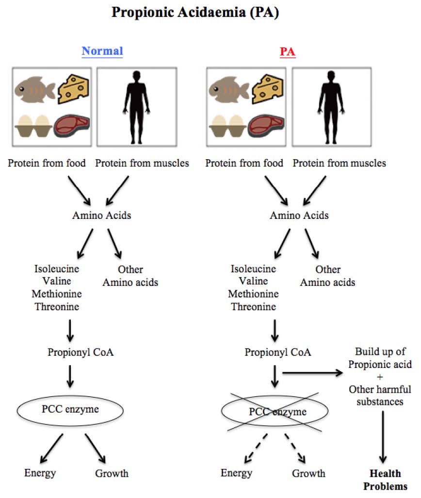Propionic acidaemia diagram