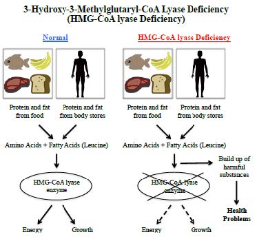 3-Hydroxy-3-Methylglutaryl-CoA Lyase Deficiency diagram
