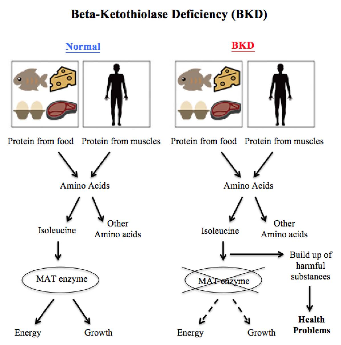 Beta-ketothiolase deficiency diagram