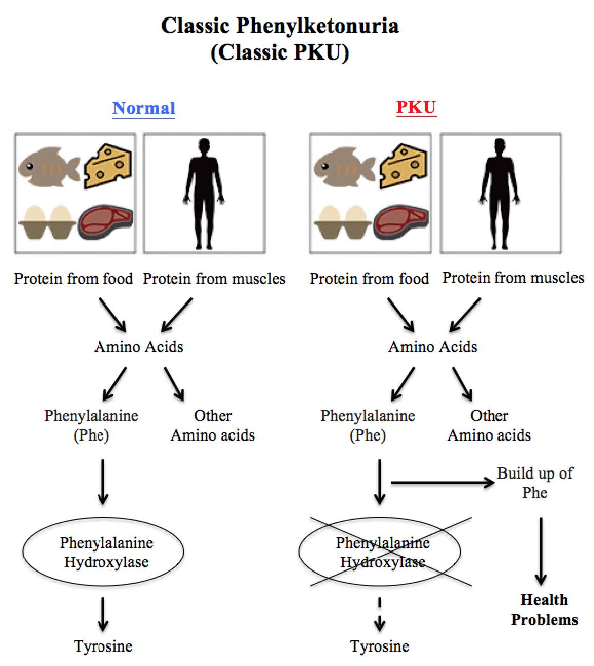 Classic phenylketonuria diagram