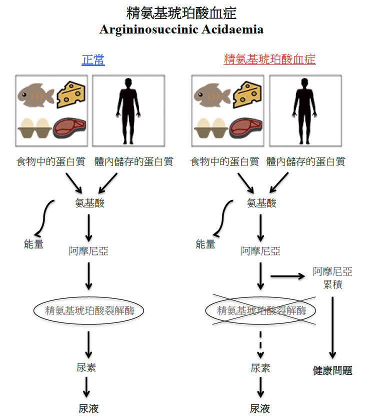 精氨基琥珀酸血症圖解