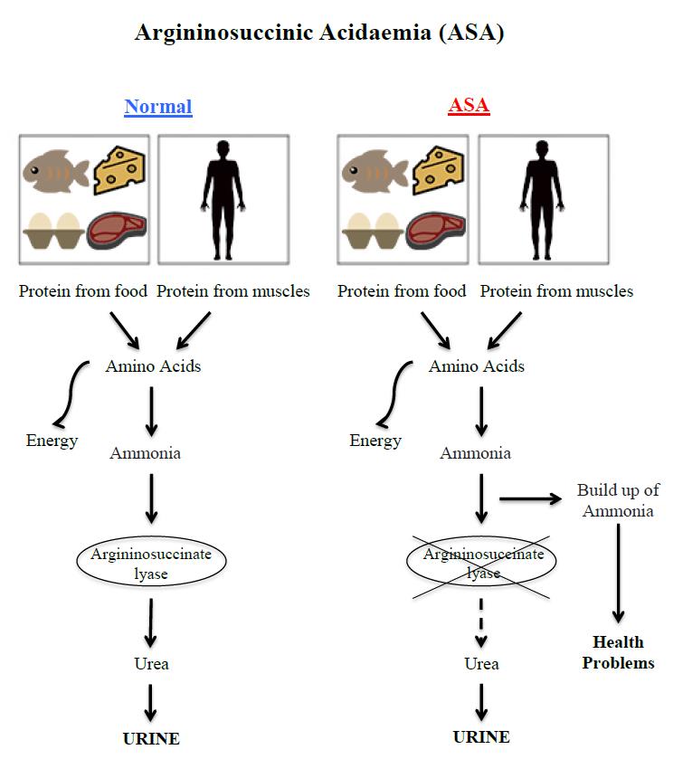 Argininosuccinic acidaemia diagram