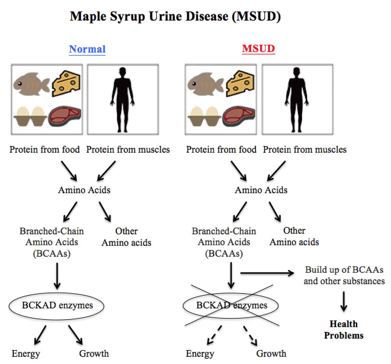 Maple syrup urine disease diagram