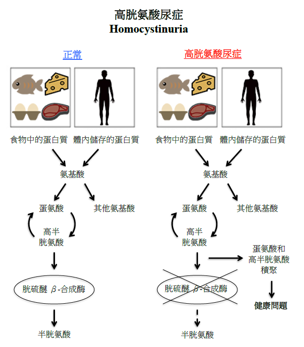 高胱氨酸尿症圖解