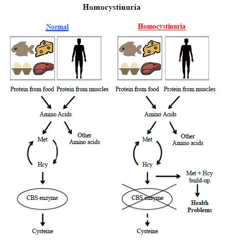 Homocystinuria diagram