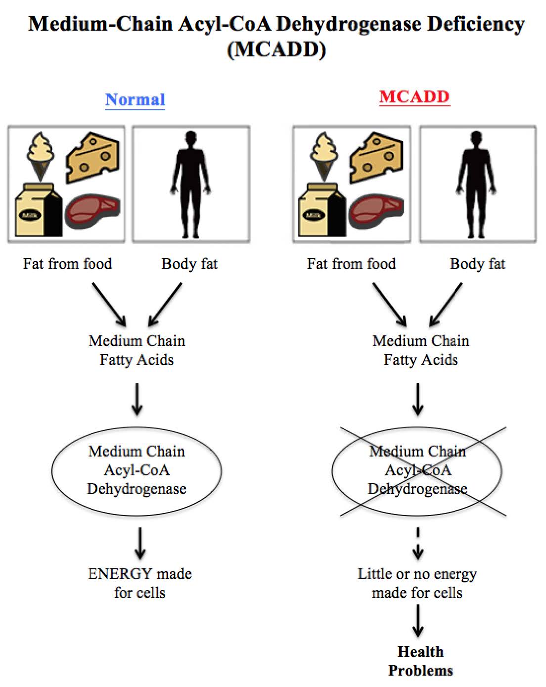Medium-chain acyl-CoA dehydrogenase deficiency diagram