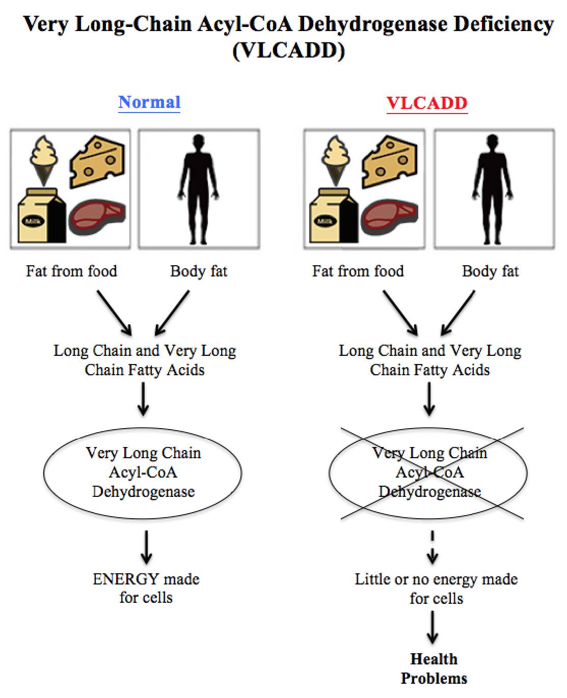 Very long-chain acyl-CoA dehydrogenase deficiency diagram