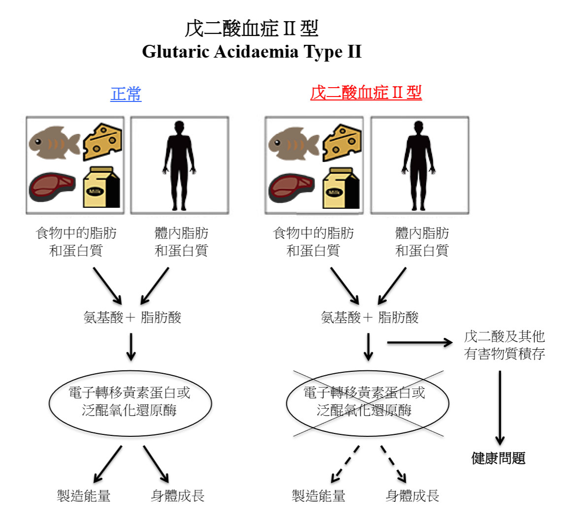 戊二酸血症 II 型圖解