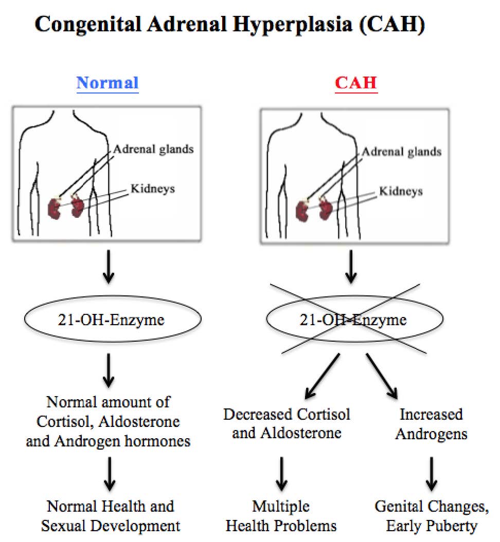 Congenital adrenal hyperplasia diagram