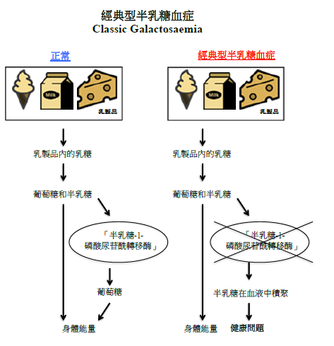 經典型半乳糖血症圖解