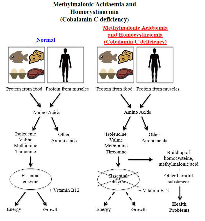Methylmalonic Acidaemia and Homocystinaemia (Cobalamin C deficiency) diagram