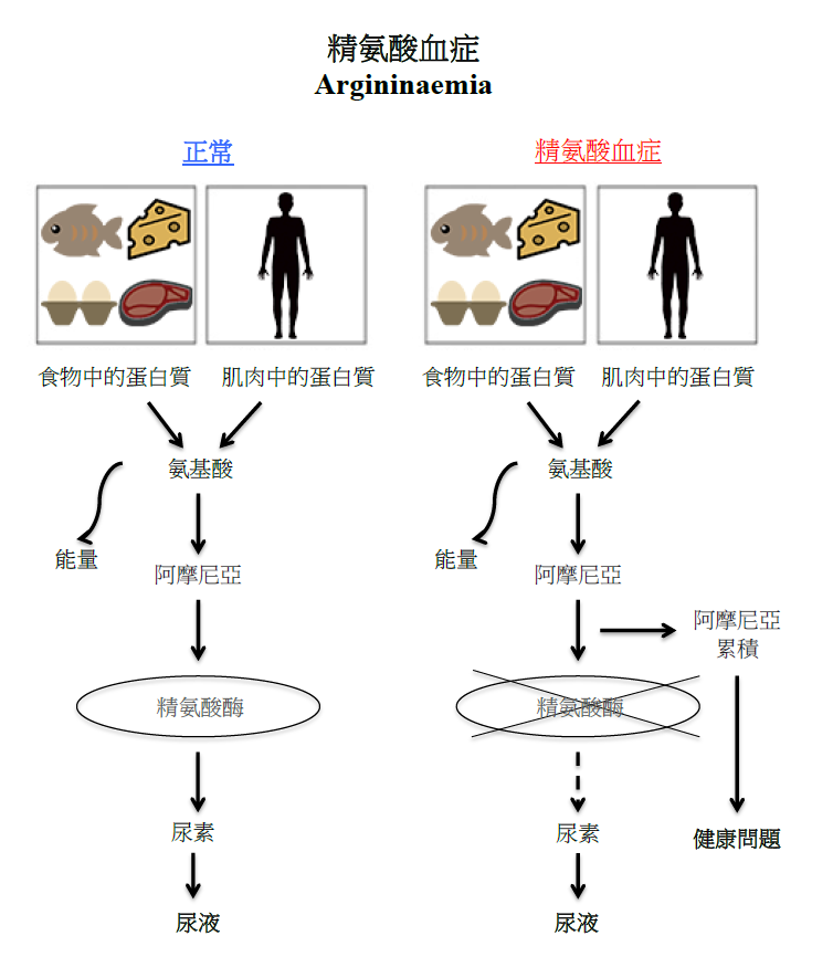 精氨酸血症圖解