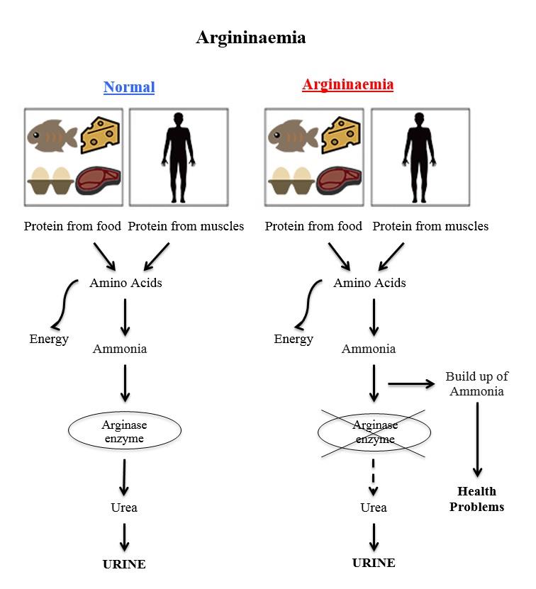 Argininaemia diagram