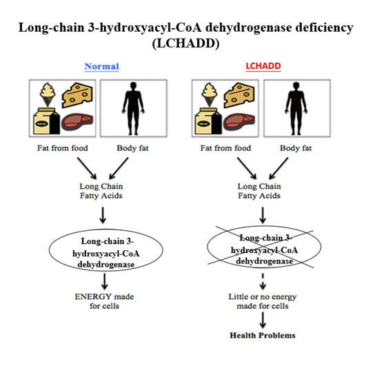 Long-chain 3-Hydroxyacyl-CoA Dehydrogenase Deficiency diagram