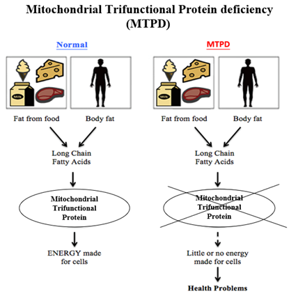 Multiple Trifunctional Protein deficiency (MTPD) diagram